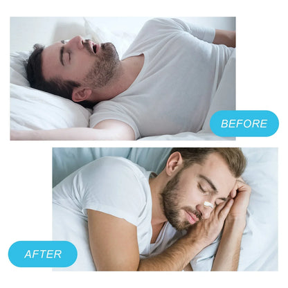 Easy Breathe Magnetic Nasal Strips - Wholesalus