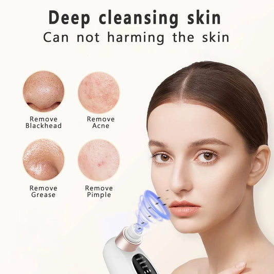 Acne Black Head Deep Clean Removal - Wholesalus