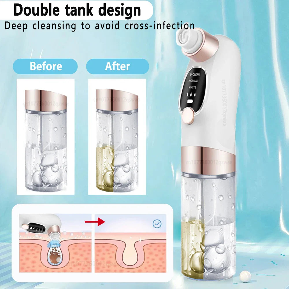Acne Black Head Deep Clean Removal - Wholesalus