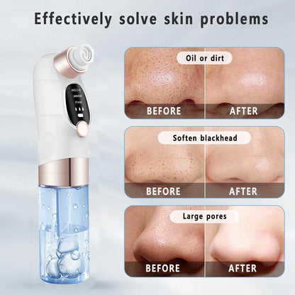 Acne Black Head Deep Clean Removal - Wholesalus