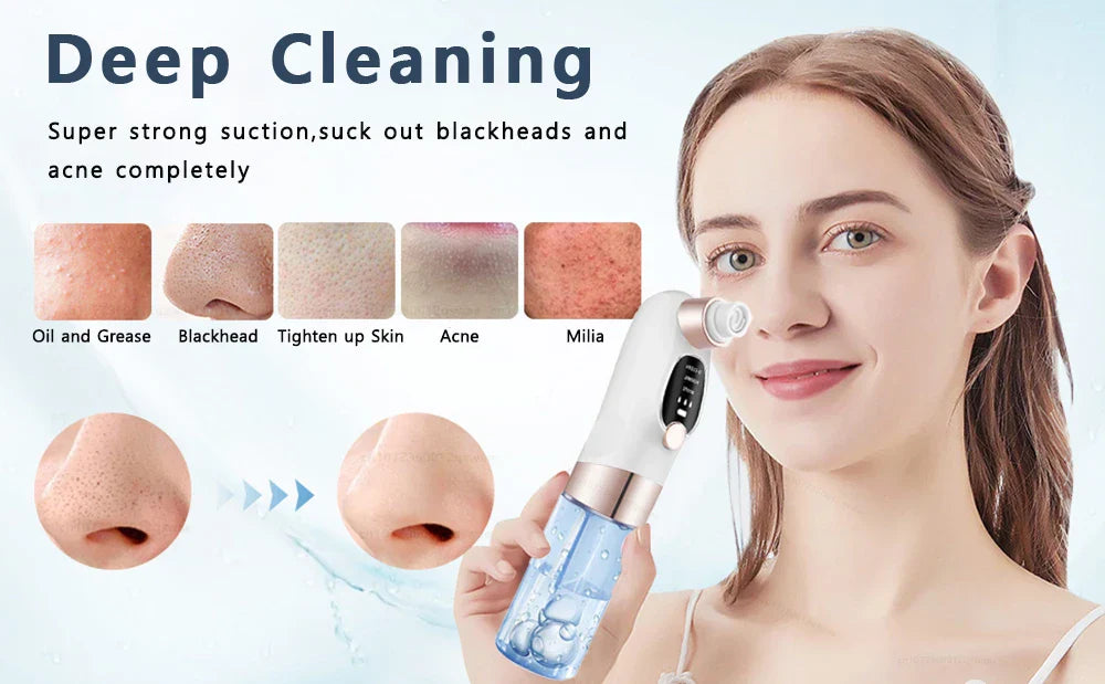 Acne Black Head Deep Clean Removal - Wholesalus