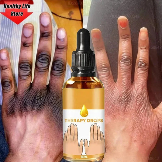 Dark Spot Removal Serum - Wholesalus