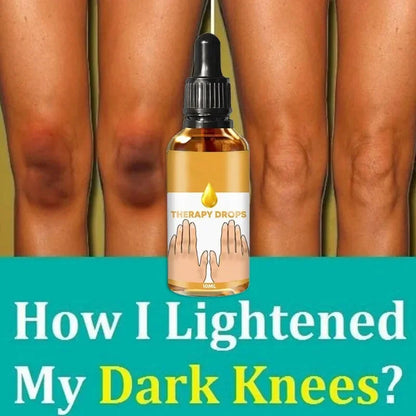 Dark Spot Removal Serum - Wholesalus