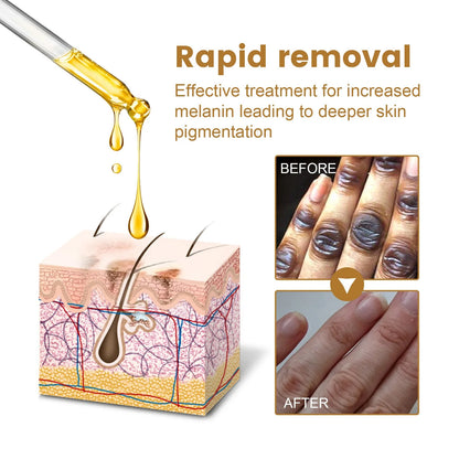 Dark Spot Removal Serum - Wholesalus