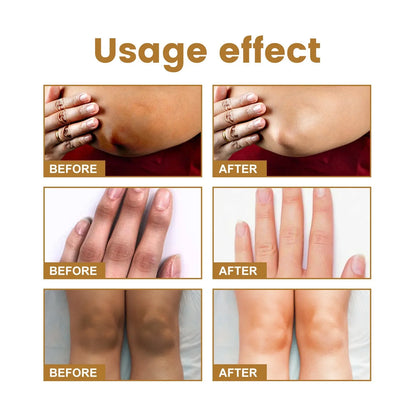 Dark Spot Removal Serum - Wholesalus