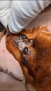 Deep Clean Peel Off Blackhead Removal - Wholesalus