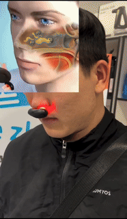 Infrared Rhinitis Laser Device - Wholesalus