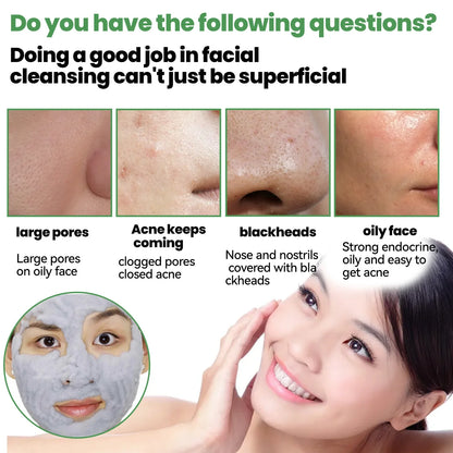 Moisturizing Carbonated Bubble Blackheads Removal - Wholesalus
