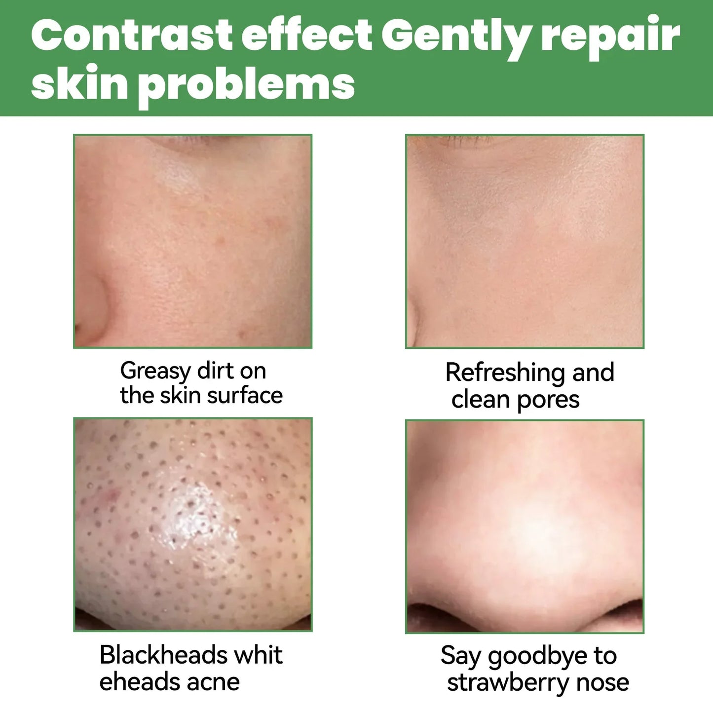 Moisturizing Carbonated Bubble Blackheads Removal - Wholesalus