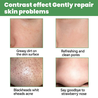Moisturizing Carbonated Bubble Blackheads Removal - Wholesalus