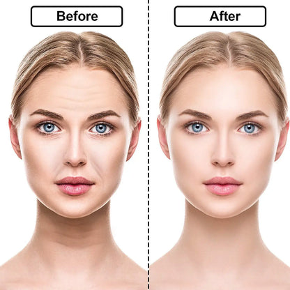 Reusable Anti Wrinkle Silicone Sticker 16 Pcs - Wholesalus