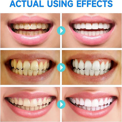 Herbal Stain Removal Whitening Toothpaste - Wholesalus